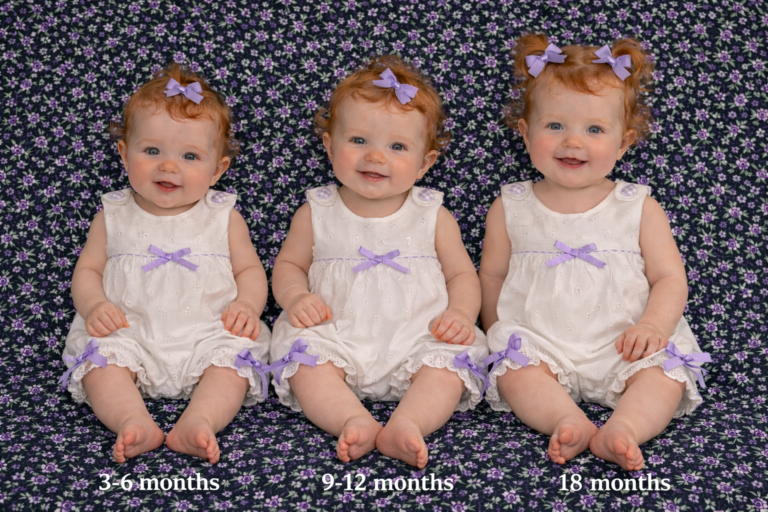 Eyelet age progression