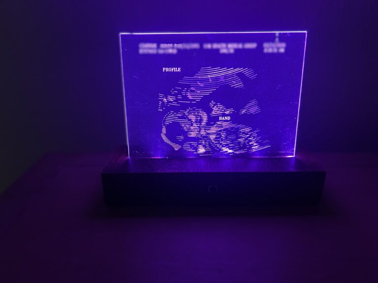 Stunning Illuminated Ultrasound Image on Acrylic-Exclusive Baby Memory Keepsake 1 Illuminated etched ultrasound image, with a variety of color options.