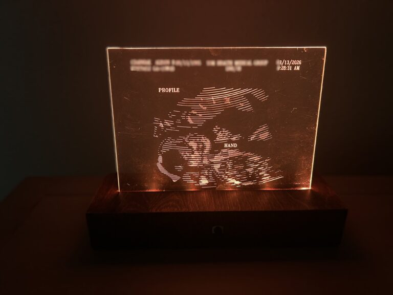 Stunning Illuminated Ultrasound Image on Acrylic-Exclusive Baby Memory Keepsake 2 Illuminated etched ultrasound image with LED lighting with a variety of color choices.