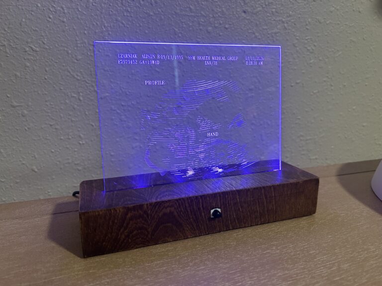 Stunning Illuminated Ultrasound Image on Acrylic-Exclusive Baby Memory Keepsake 3 Etched ultrasound on illuminated base